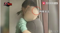 郴州再现“大头娃娃”，调查启动