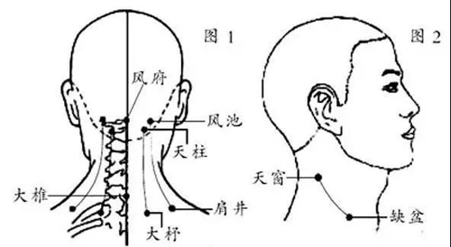 风池穴、风府穴、大椎穴、肩井穴