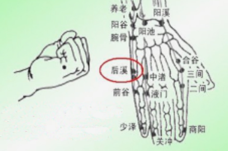 针灸：阳溪+后溪，治疗肛门瘙痒