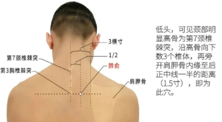 肺五针，治各种肺病的效穴