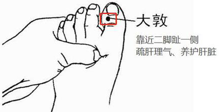 大敦点刺放血治急性耳鸣